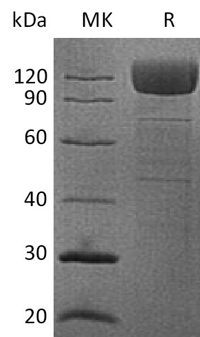 Human CD36 +SDS-PAGE.jpg